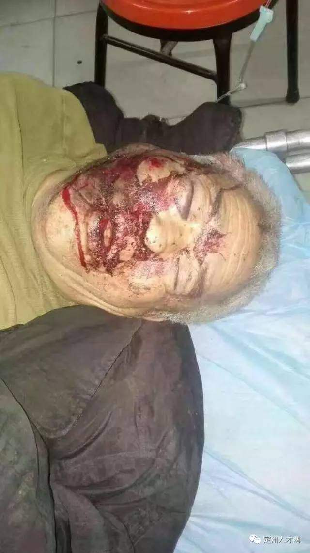 澳客课程-切塞纳球员迷失在山区，俱乐部紧急寻人寻救